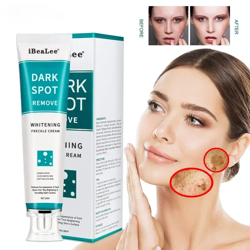 Skincare Glowing - Whitening Freckle Cream Remove Dark Spots
