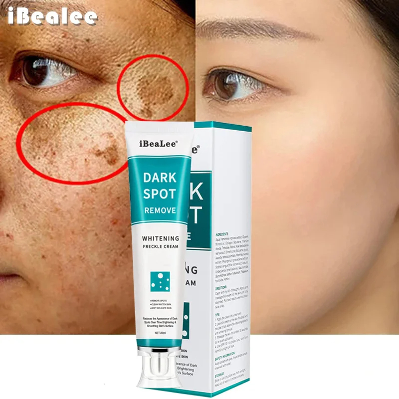Whitening Freckle Cream Remove - Skincare Glowing review and price